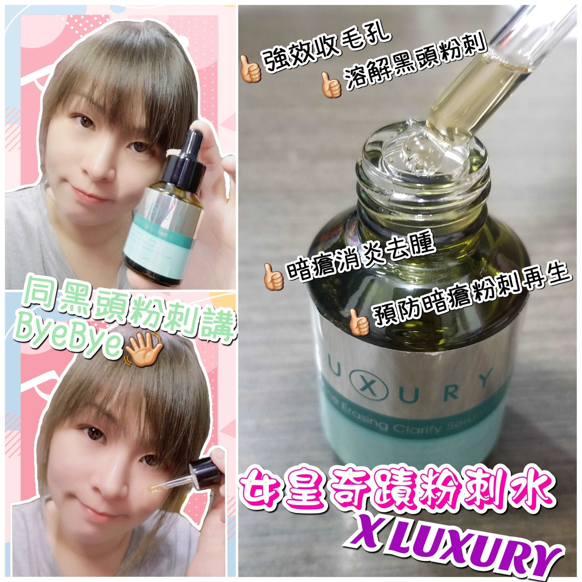 XLUXURY 女皇奇蹟粉刺水 30ml