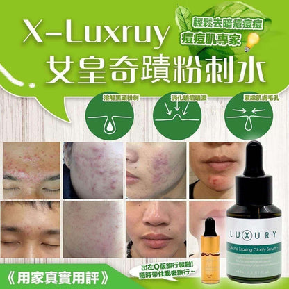 XLUXURY 女皇奇蹟粉刺水 30ml